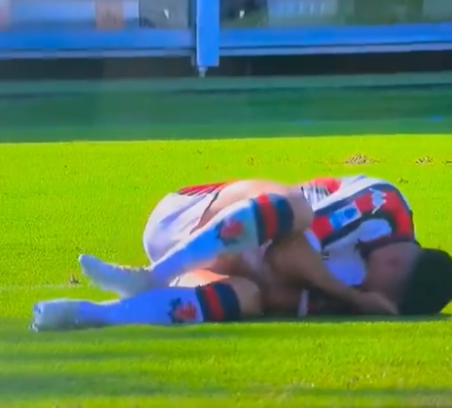 JEZIVA SCENA U VENECIJI Hteo je da ispuca loptu što dalje od gola, a umesto toga slomio je nogu (VIDEO)