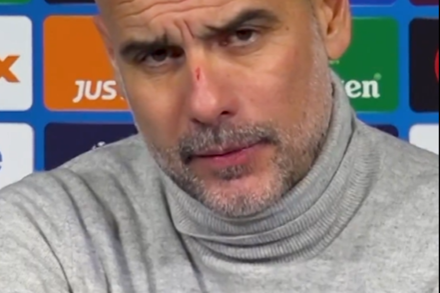 Gvardiola o ogrebotinama na glavi: Tri godine uzimam lekove