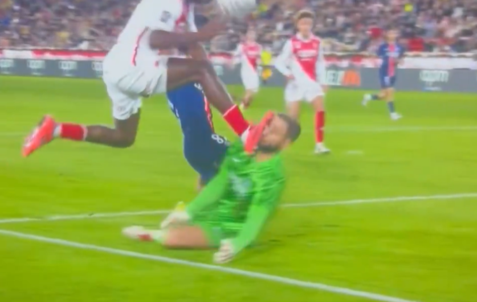 HOROR SLIKA Donarumino lice skroz isečeno i u koncima, a sudija Singu nije pokazao ni žuti karton (VIDEO)